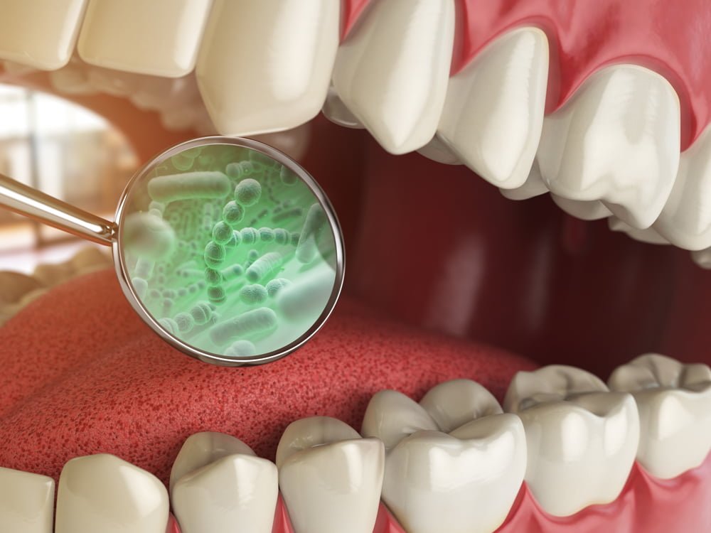 Image of harmful bacteria inside mouth cavity under a loupe